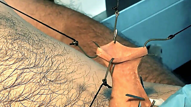 An Artful Study in Needles and Steel